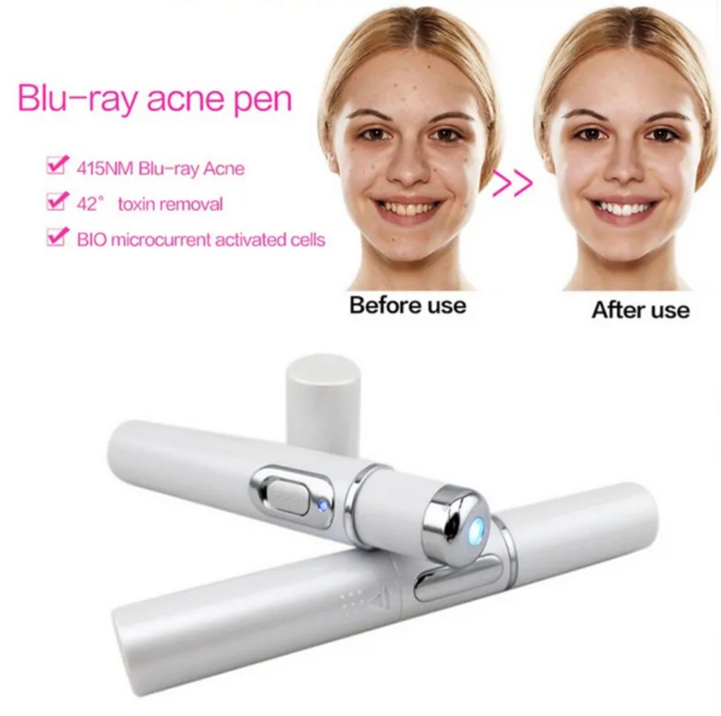 Blue Light Therapy Acne Pen