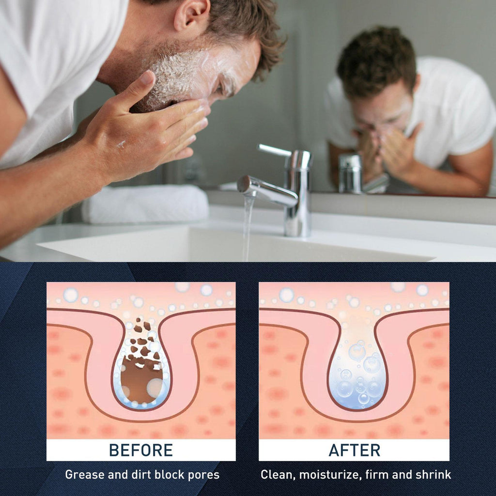 Men's Exfoliating Mousse for Acne and Oil Control