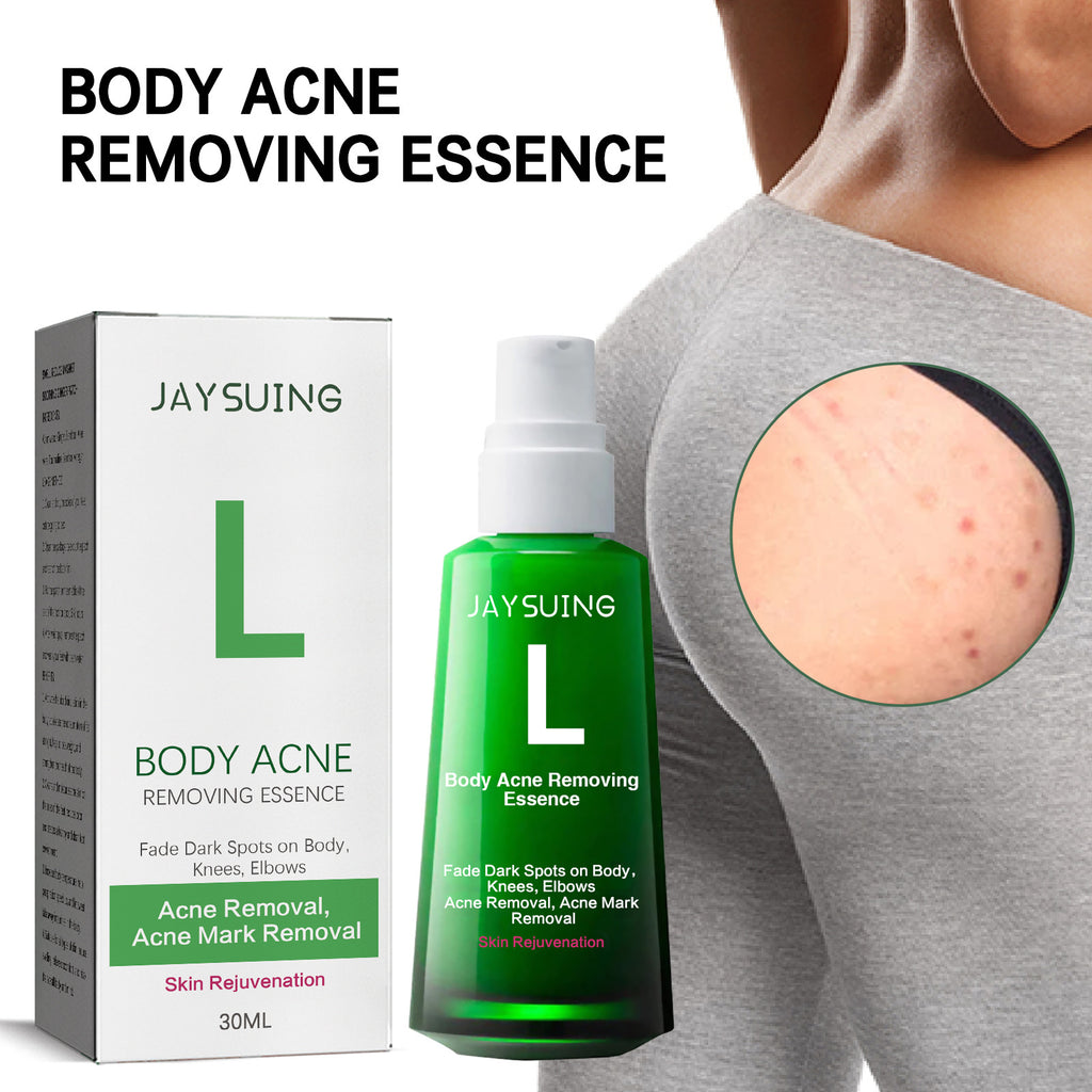Jaysuing Acne Spot Lightening Serum for Skin Care